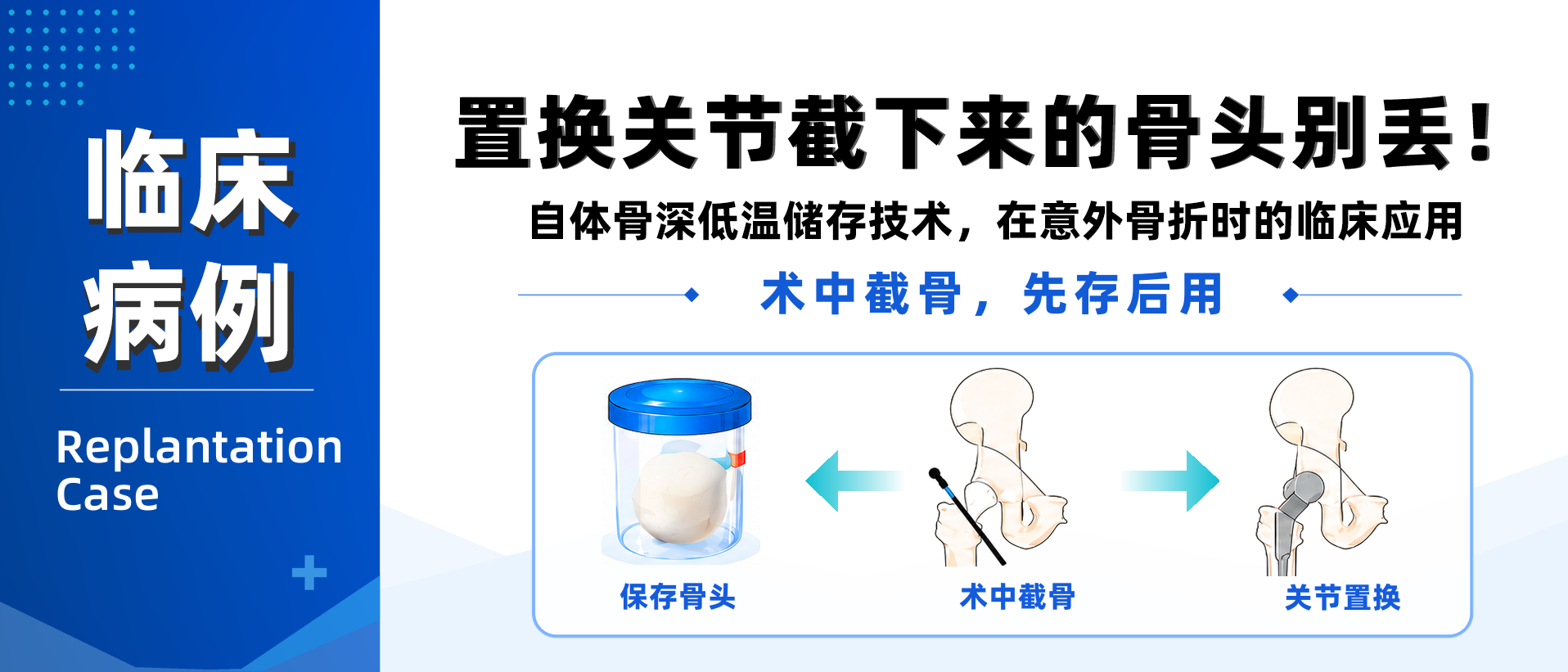 四川大学华西医院自体骨储存临床应用病例