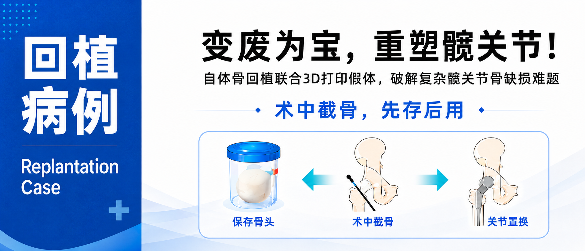 成都市第三人民医院自体骨回植病例