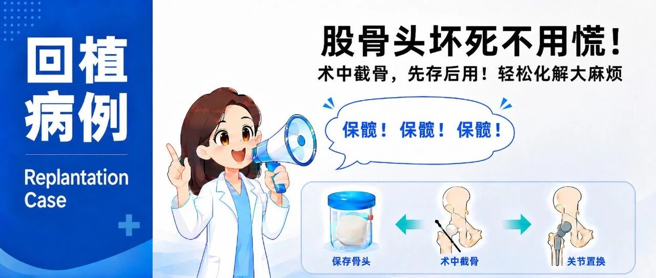 股骨头坏死不用慌！术中截骨，先存后用！复旦大学附属中山医院自体骨回植病例