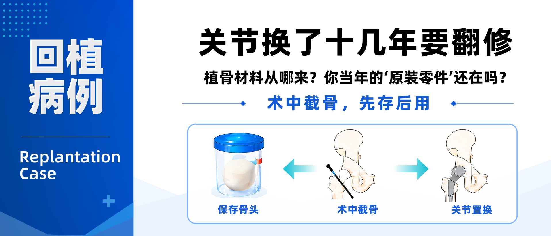  关节换了十几年要翻修  植骨材料从哪来？  你当年的‘原装零件’  还在吗？