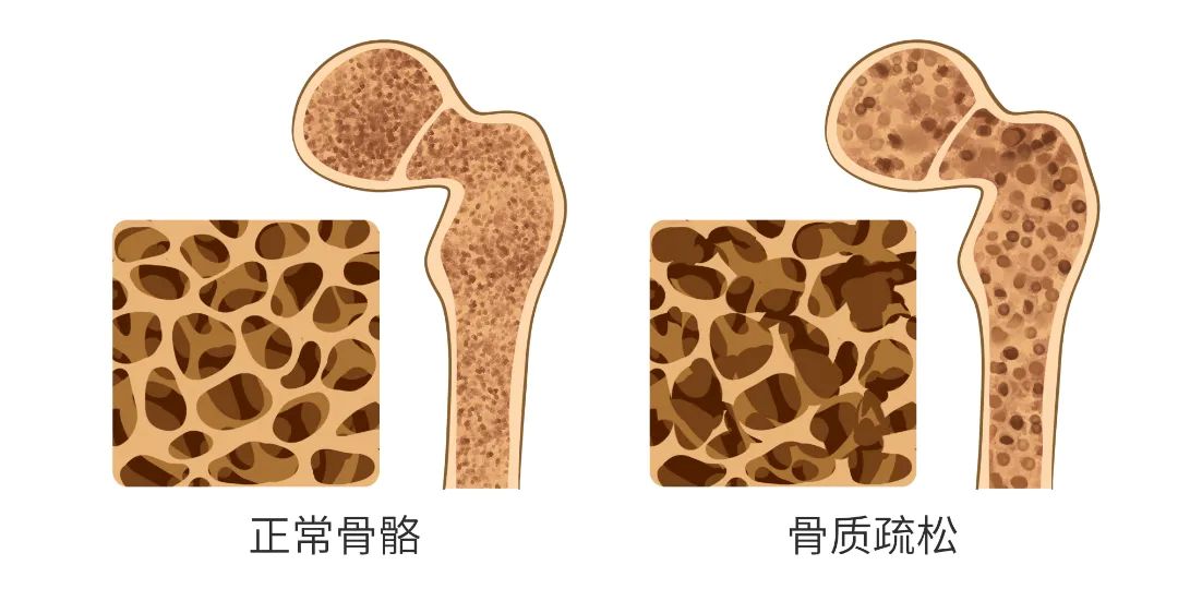 骨骼结构比较.jpg