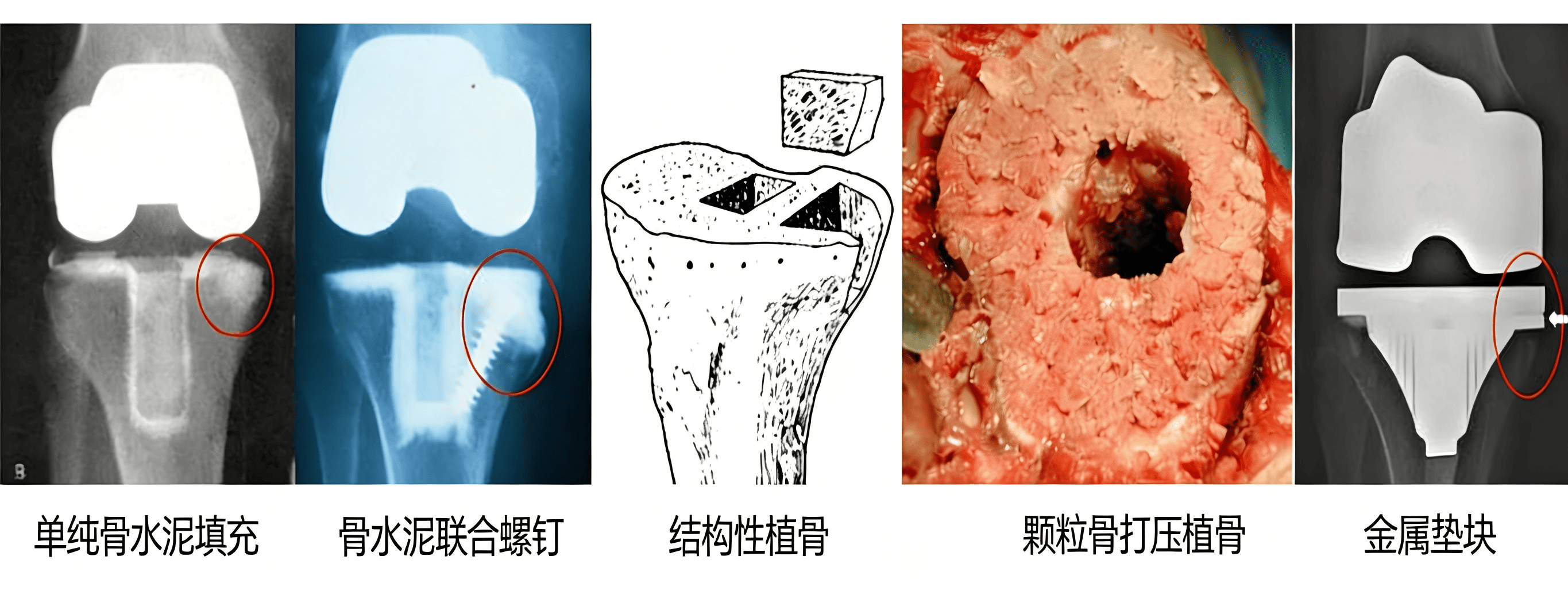 去除公众号水印(1) (1).png