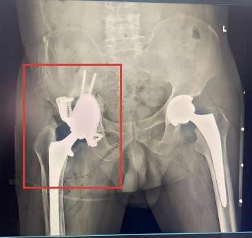 后(1).png